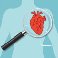 What Men Need to Know About Coronary Artery Disease Pathophysiology and Heart Care