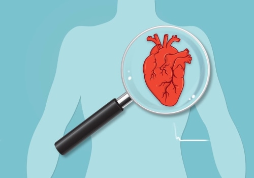 What Men Need to Know About Coronary Artery Disease Pathophysiology and Heart Care